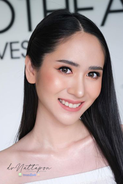 วีเนียร์ K.Kate